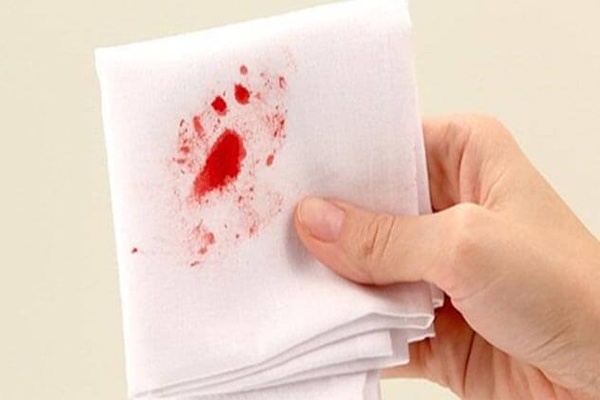 Chảy máu ở âm đạo là dấu hiệu cho thấy màng trinh bị rách Chảy máu ở âm đạo là dấu hiệu cho thấy màng trinh bị rách
