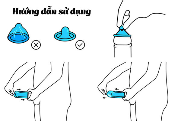 Hướng dẫn sử dụng bao cao su Storm 7 bi đúng cách