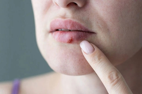 Có thể ảnh hưởng đến sức khỏe khi bạn tình mắc bệnh Có thể ảnh hưởng đến sức khỏe khi bạn tình mắc bệnh