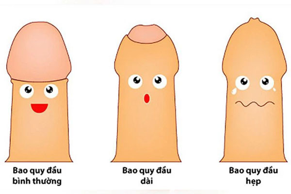 Bao quy đầu bình thường sẽ dễ dàng lột lên và xuống mà không đau. Bao quy đầu bình thường sẽ dễ dàng lột lên và xuống mà không đau.