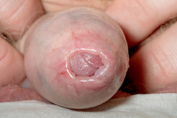 Khô và nứt nẻ bao quy đầu là một hiện tượng thường gặp ở nam giới. Khô và nứt nẻ bao quy đầu là một hiện tượng thường gặp ở nam giới.